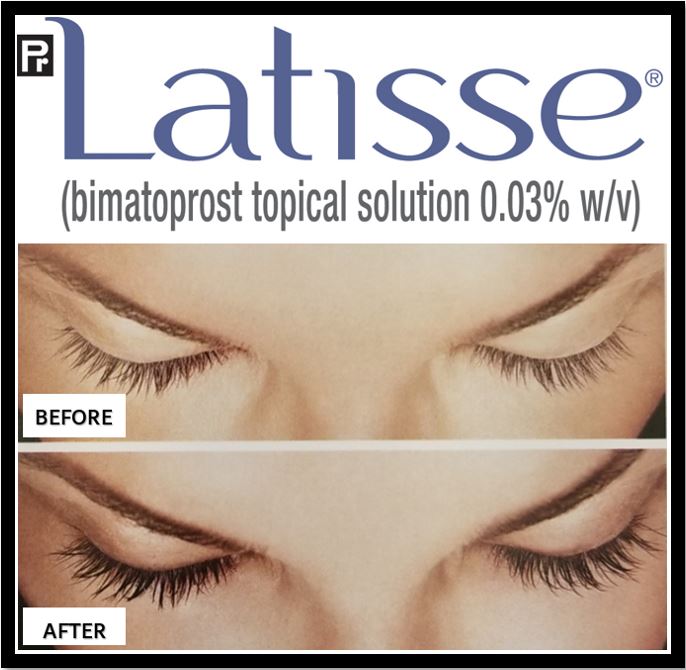 Eyelash growth treatment at CURA EyeCare Optometry