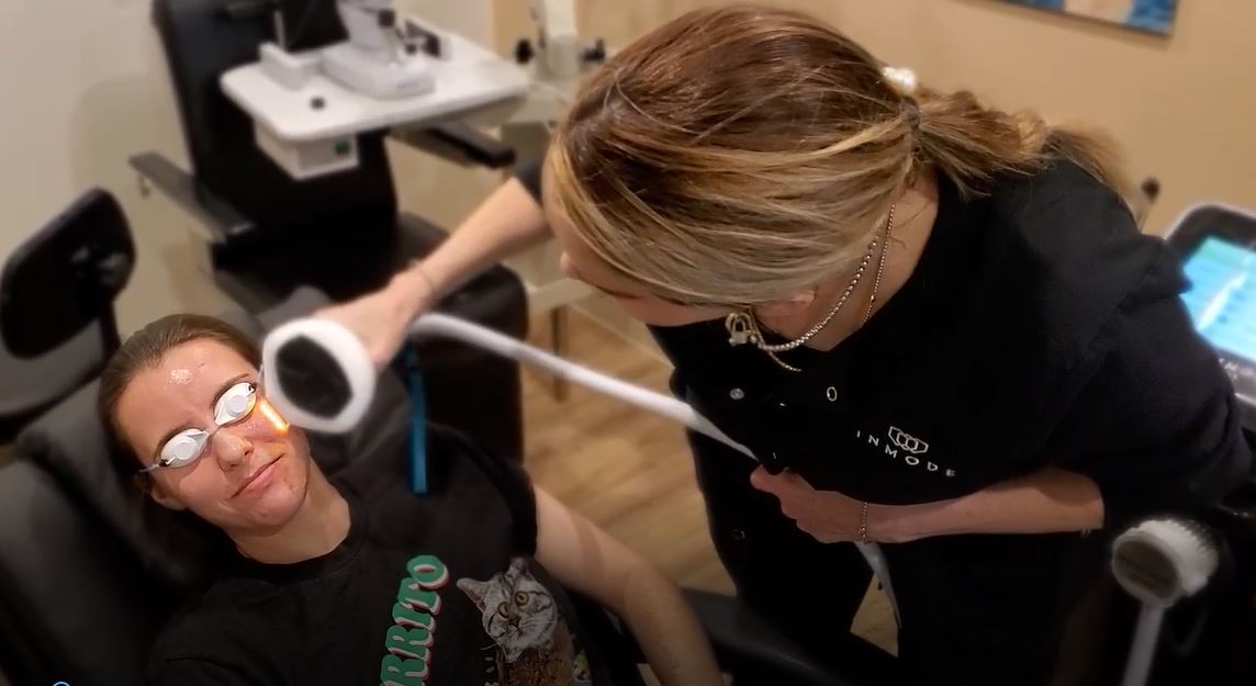 CURA EyeCare Optometry Dry Eye Treatment